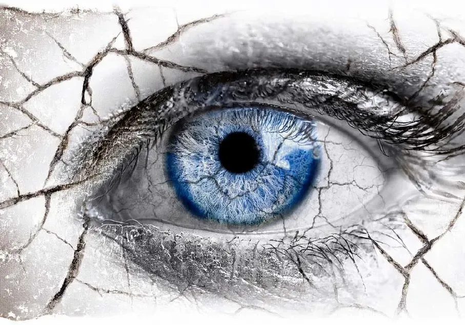dry-eye-1000x700-v2.webp
